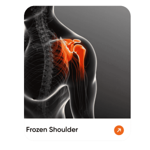 Frozen Shoulder