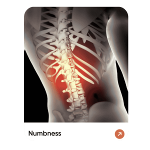 Numbness