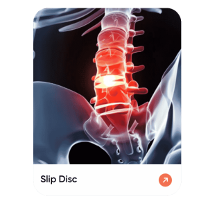 Slip Disc (1)
