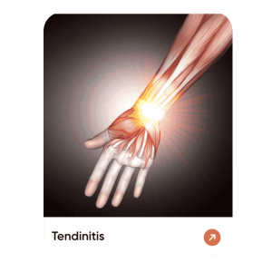 Tenditis